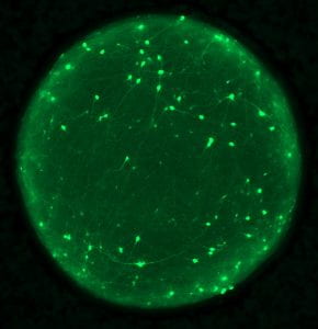 Organoid with neurons labeled in green (Image by Josh Berlind/Ichida Lab)